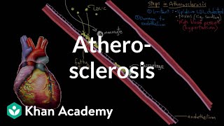 Atherosclerosis  Circulatory System and Disease  NCLEXRN  Khan Academy [upl. by Aierb849]