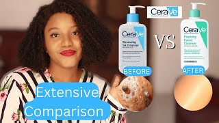 Which is best for your Acne Prone Skin Cerave SA Cleanser Vs Cerave Foaming Cleanser [upl. by Asssilem]