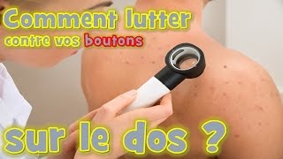 bouton dacné  Comment lutter naturellement contre vos boutons sur le dos [upl. by Epolulot793]