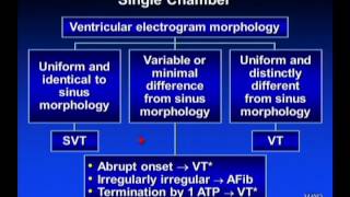 ICD Troubleshooting  Dr Friedman Mayo Clinic [upl. by Jourdan]