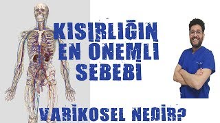 Varikosel Nedir ve Neden Olur [upl. by Aikyt]