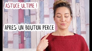 2 produits INCONTOURNABLES pour faire CICATRISER son BOUTON après l’avoir percé [upl. by Eilla]