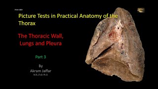 Picture Tests in Anatomy  Thorax  Wall and Lung 3 [upl. by Drawoh176]