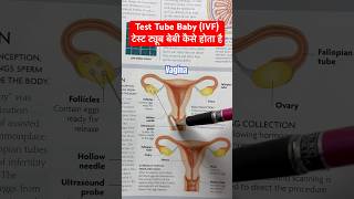 Test Tube Baby  IVF  in vitro fertilisation ivf shorts [upl. by Amuh472]