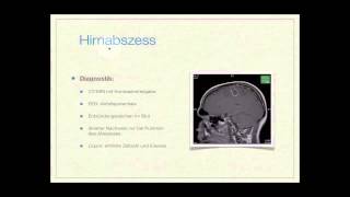 Basiskurs Neurologie Entzündliche Erkrankungen Teil 814 [upl. by Hauge]