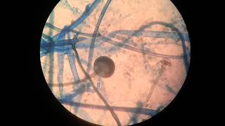 Rhizopus [upl. by Anod]