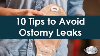 Common Ostomy Issues My Ostomy Bag Keeps Leaking [upl. by Moberg]