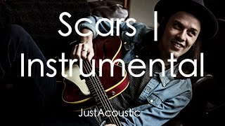 Scars  James Bay Acoustic Instrumental [upl. by Nelson]