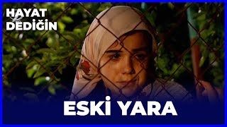 Hayat Dediğin  Eski Yara [upl. by Naicad]