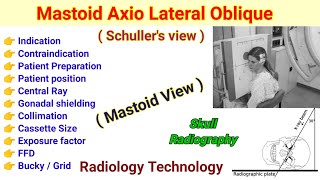 Mastoid Axio Lateral Oblique view  Schullers View in Hindi  Mastoid View [upl. by Meggy]