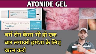 Atonide gel use dose benefits and side effects full review in hindi [upl. by Yecam329]