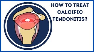 How to treat calcific tendonitis [upl. by Adnahsal]