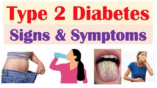 Type 2 Diabetes Signs amp Symptoms amp Why They Occur amp Associated Conditions [upl. by Kerstin]