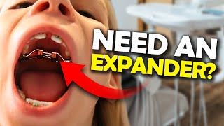 Getting a Palatal Expander What you NEED to know  McKinney Orthodontist [upl. by Gunar337]