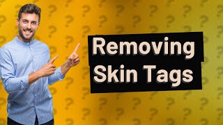 Can you reverse skin tags [upl. by Fletcher]