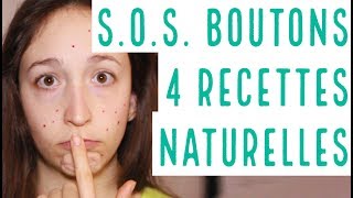 SOS BOUTONS  4 astuces MAISON pour les faire partir RAPIDEMENT et NATURELLEMENT [upl. by Idelia]