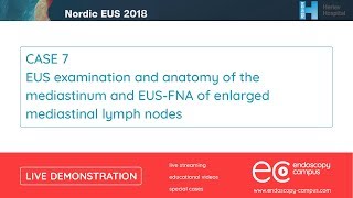 Livedemo  Nordic EUS 2018  EUS examination and anatomy of the mediastinum [upl. by Cruickshank]