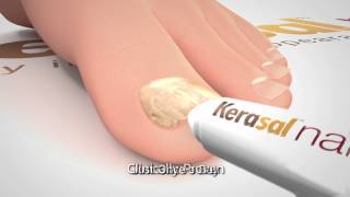 Kerasal Nail Restore Healthy Nail Appearance 30 Sec [upl. by Akino]