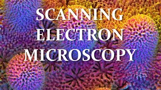 Scanning Electron Microscopy SEM Amazing Things Seen Under Microscope Everything you need to know [upl. by Yert]