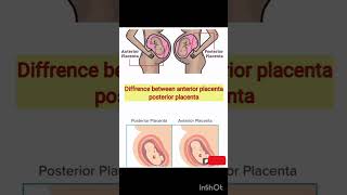 Difference between anterior placenta posterior placenta  anterior  posterior [upl. by Assennev]