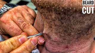 ASMR BEARD CUT • Beard ingrown hairs and cleaning beard [upl. by Anemolihp]