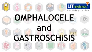 Omphalocele and Gastroschisis [upl. by Stephen]