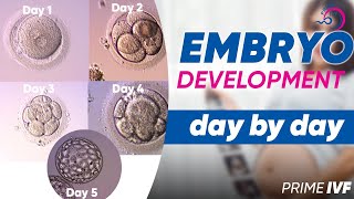 Embryo Development Day By Day in Hindi  Best Blastocyst Clinic in Gurgaon  Prime IVF [upl. by Tabina]