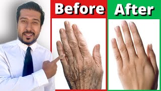 2 Fast Remedies for Dry and Wrinkled Hands THAT WORK [upl. by Macomber]