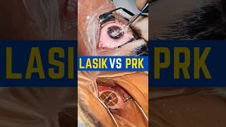 LASIK VS PRK [upl. by Aymer892]