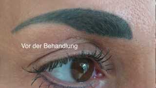 Permanent Makeup Entfernung der Augenbrauen [upl. by Jala890]