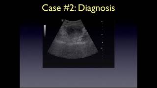 Transabdominal Pelvic Ultrasound [upl. by Otrebireh]