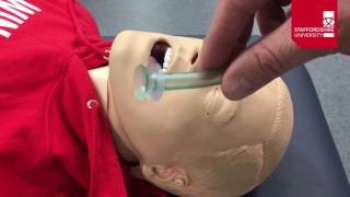 Nasopharyngeal Airway Insertion [upl. by Snapp]