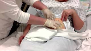 Colostomy Care Teaching Video [upl. by Nodnorb]