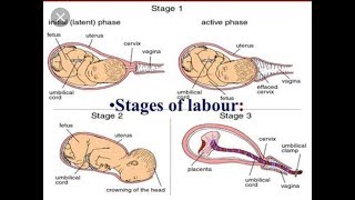 Stages of Labour [upl. by Timotheus]