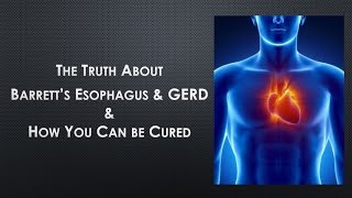 How To Cure Barretts Esophagus  The Truth About Barretts Esophagus [upl. by Nilahs719]