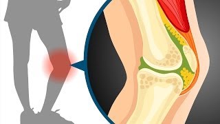 Sliding filament theory in muscle contraction  Wellcome [upl. by Aydni]