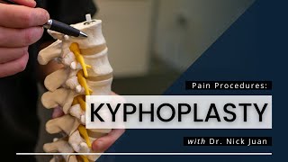 Kyphoplasty What You Need To Know [upl. by Laehctim]