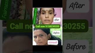 Fairness cream 101result buaty beauty makeup makeupartist [upl. by Sualkin]