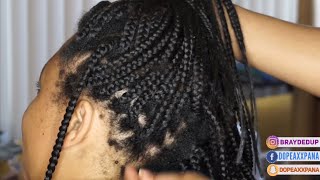 OMG 2 12 Month Old Box Braid Take Down So Much BREAKAGE  Hair Growth Transformation 2 [upl. by Jaret]