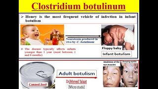 Clostridium botulinum Botulism disease quotMedical microbiology [upl. by Ecnarretal]