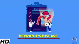 How To Treat Peyronie’s Disease  Treatment Options for Peyronies Disease [upl. by Elane]