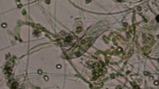 Microscopic View of 5 uL Pond Water [upl. by Gnouhc]