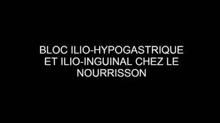 BLOC ILIO HYPOGASTRIQUE ET ILIO INGUINAL ÉCHOGUIDÉ CHEZ LE NOURRISSON [upl. by Arte767]