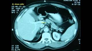 Cross sectional and imaging anatomy of the abdomen [upl. by Ammej]