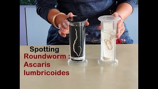 How to do SPOTTING  Biology Practical Class 12  Roundworm  Ascaris lumbricoides [upl. by Winola]