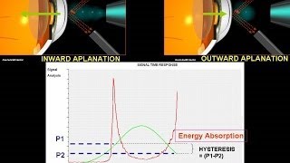 How does ocular response analyser works [upl. by Sheila]