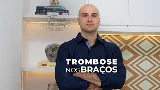 Trombose nos braços [upl. by Durrace]