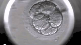 Embryoscope timelapse DanFertdk [upl. by Trilley]