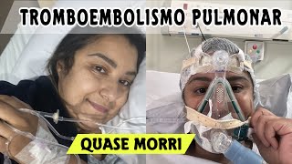 TROMBOEMBOLISMO PULMONAR O QUE ACONTECEU COMIGO INTERNAÇÃO CIRURGIA NA COLUNA UM MÊS MUITO DIFÍCIL [upl. by Natka]