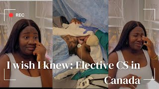 Is Canada’s caesarean section better than Nigeria’s Sharing my personal experience [upl. by Geis658]